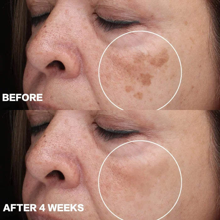 Turmeric Serum
