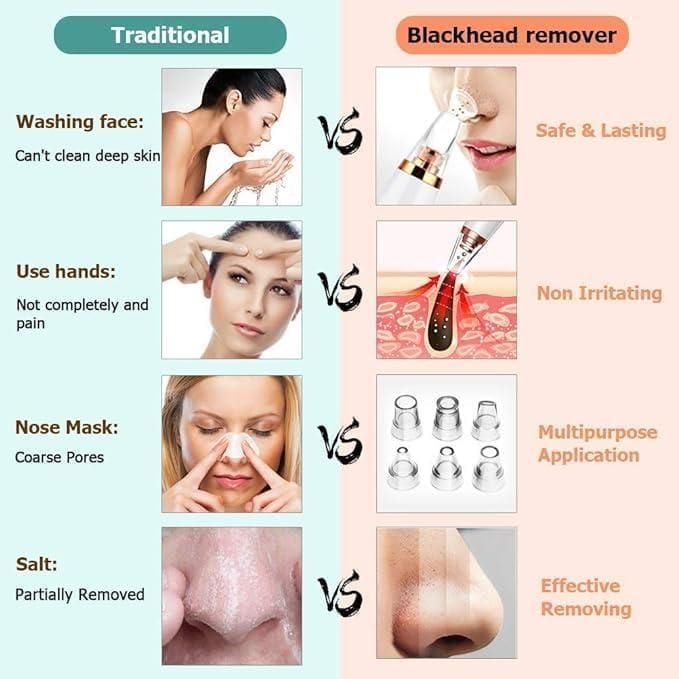 6 in 1 Multi-function Blackhead Remover Tools | Blackheads Remover Pimple Removes Open Pores Black Head Remover 6 in 1 Multi-function Blackhead Remover Tools
