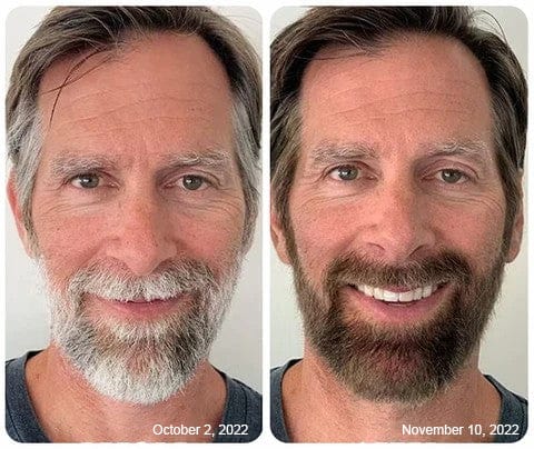 Anti-Greying Hair Darkening Serum Anti-Greying Hair Darkening Serum