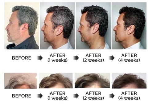 Anti-Greying Hair Darkening Serum Anti-Greying Hair Darkening Serum