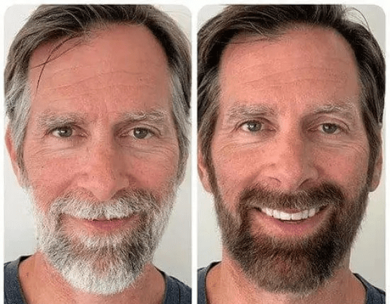 Anti-greying Hair Serum Hair Growth Serum Premature Greying Oil Serum Hair Oil Anti-greying Hair Serum