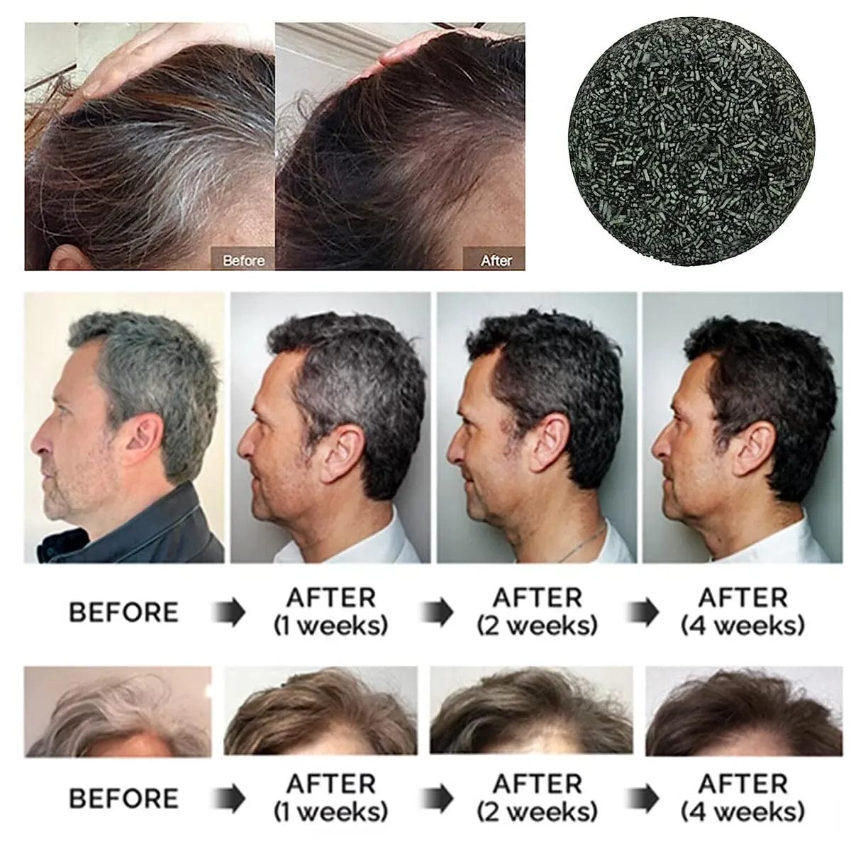 Anti-greying Hair Serum Hair Growth Serum Premature Greying Oil Serum Hair Oil Anti-greying Hair Serum