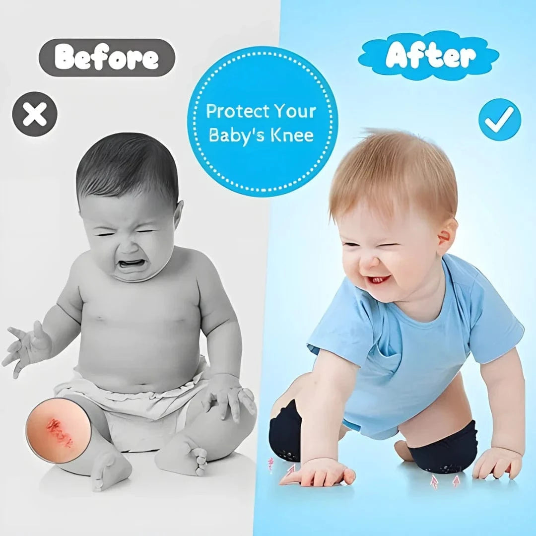 Baby Knee Pad For Safe Crawling | Baby Socks Knee Infant Leg Slipper Anti Slip Toddler Knee Sock Baby Knee Pad For Safe Crawling