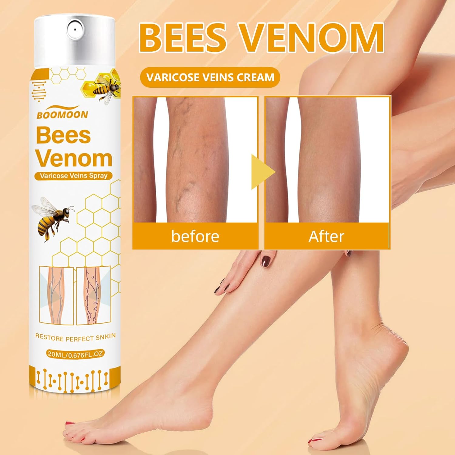 Bee Venom Varicose Veins Spray Bee Venom Varicose Veins Spray