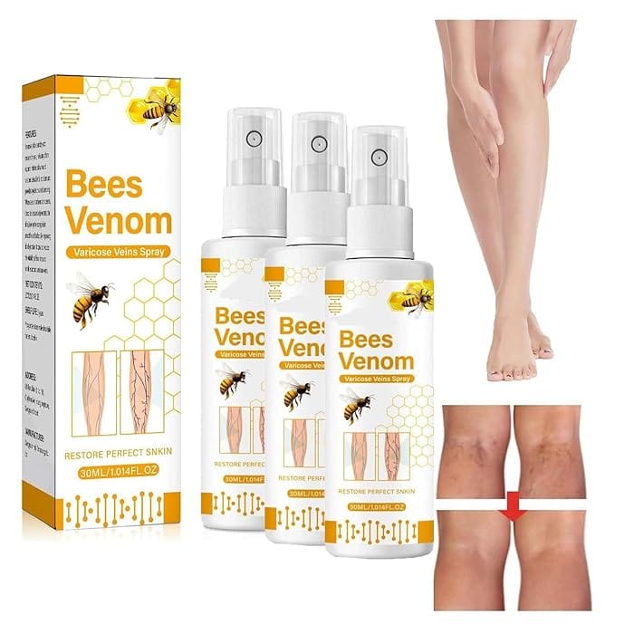 Bee Venom Varicose Veins Spray Bee Venom Varicose Veins Spray