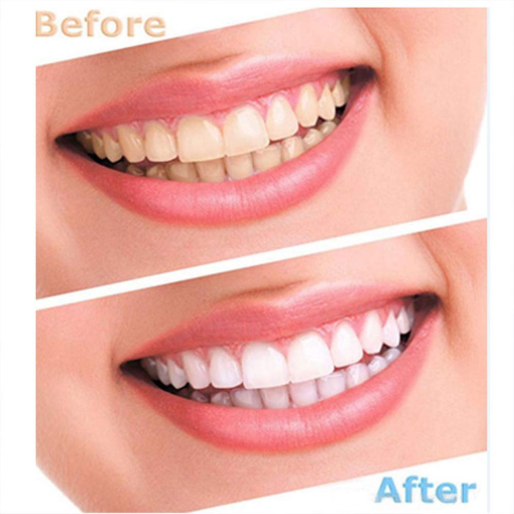 Best Teeth Whitening Polisher Stain Reomover Home Kit - Tooth Polisher Teeth Whitening Tooth Polisher