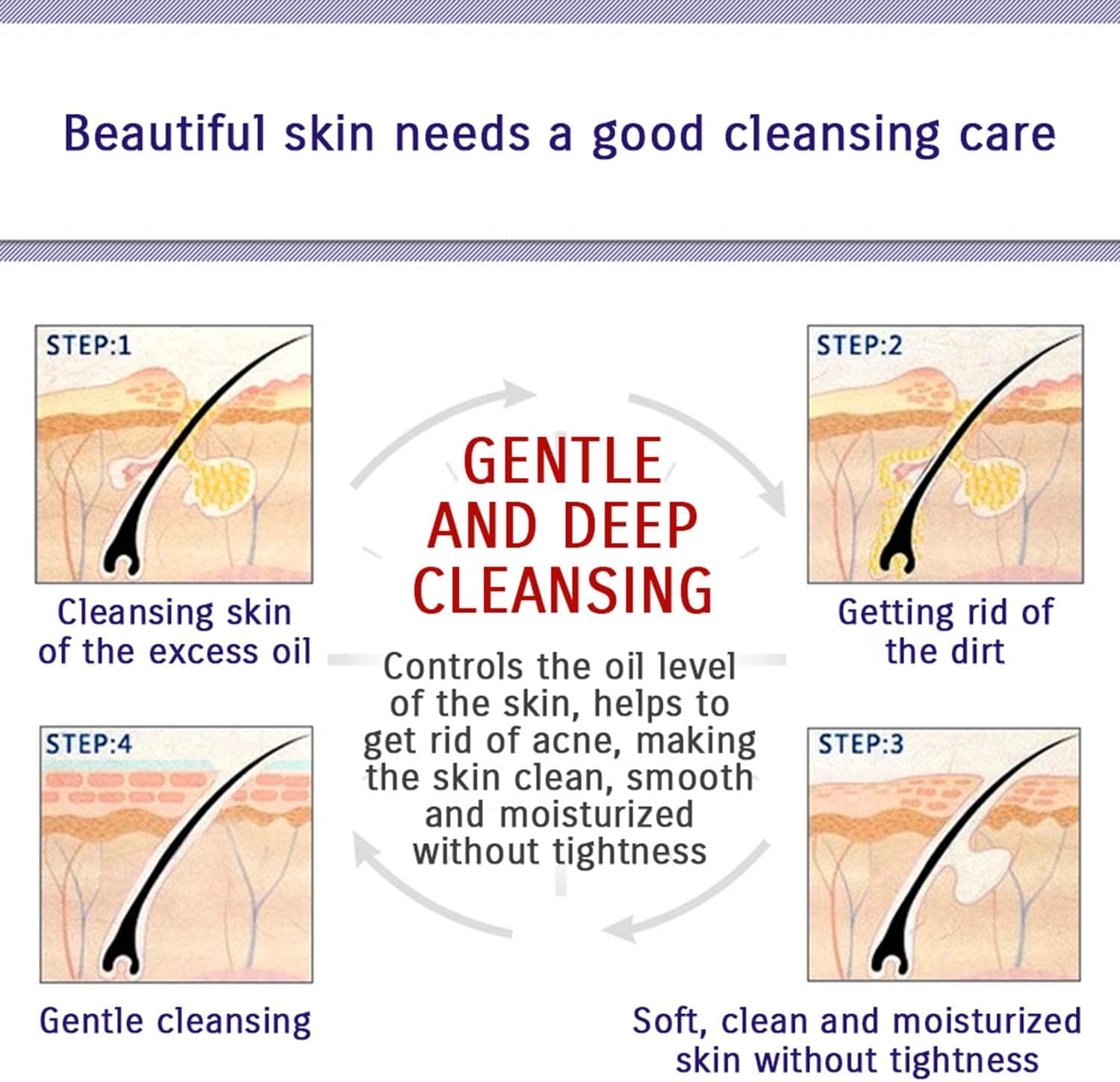 BioAqua Acne & Scar Remover (50% Off) BioAqua Acne & Scar Remover (50% Off)