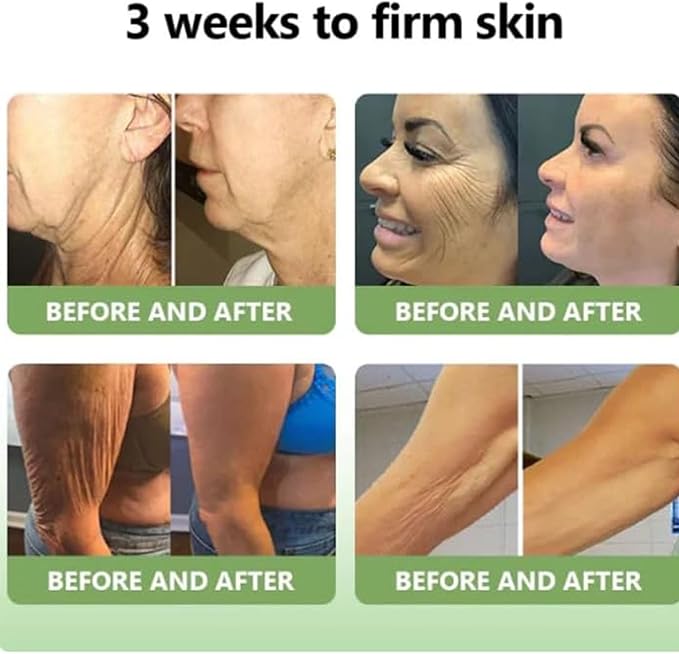 Collagen Firming Body Cream (Pack of 2) | Skin Firming Collagen Cream Moisturiser Body Lotion Collagen Firming Body Cream (Pack of 2)