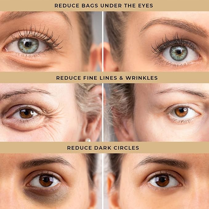 Eye Bag Cream | Under Eye Cream For Dark Circles Mosturizer Cream For Eye Instant Firm Eye Bag Cream (Pack of 2)