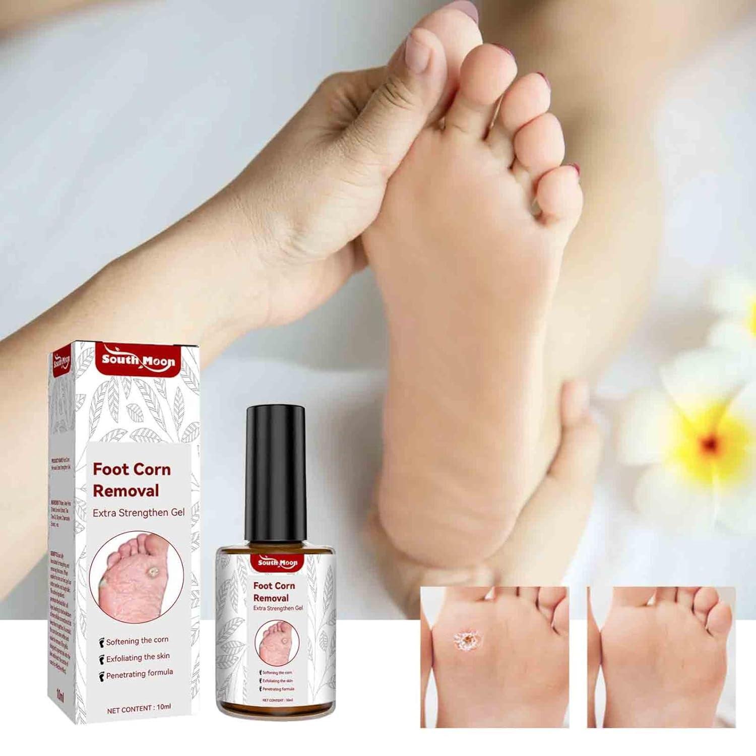 Feet Corn Removal Serum (Pack of 2) | Foot Corn Treatment Corn Healing Feet Corn Removal Serum (Pack of 2)
