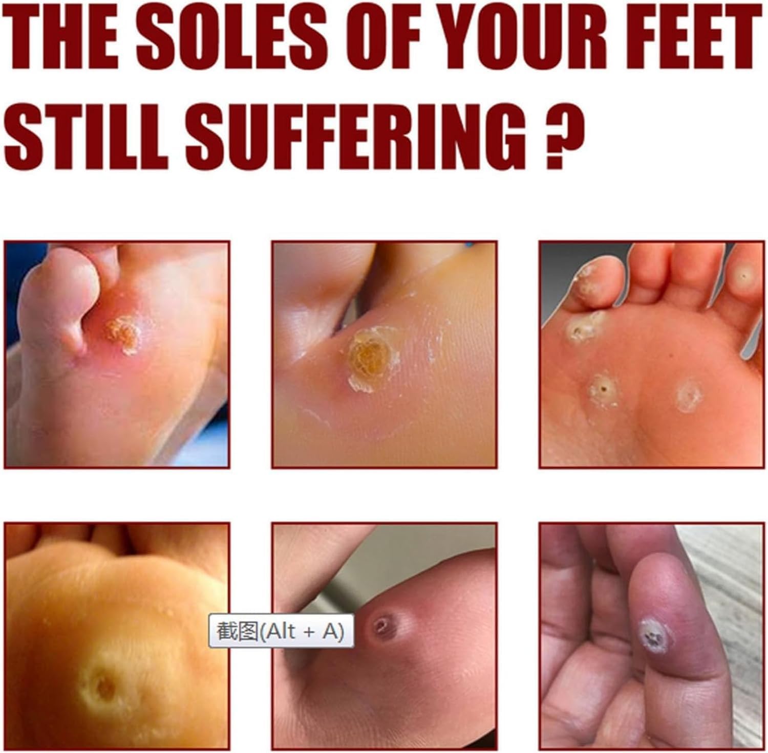 Feet Corn Removal Serum (Pack of 2) | Foot Corn Treatment Corn Healing Feet Corn Removal Serum (Pack of 2)