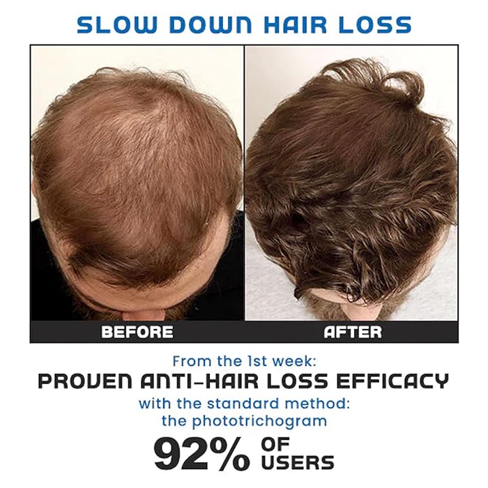 Hair Growth Serum Care Hair Solution Rolling for Regrow - Roll-on Hair Growth Treatment (Pack of 2) Roll-on Hair Growth Treatment (Pack of 2)