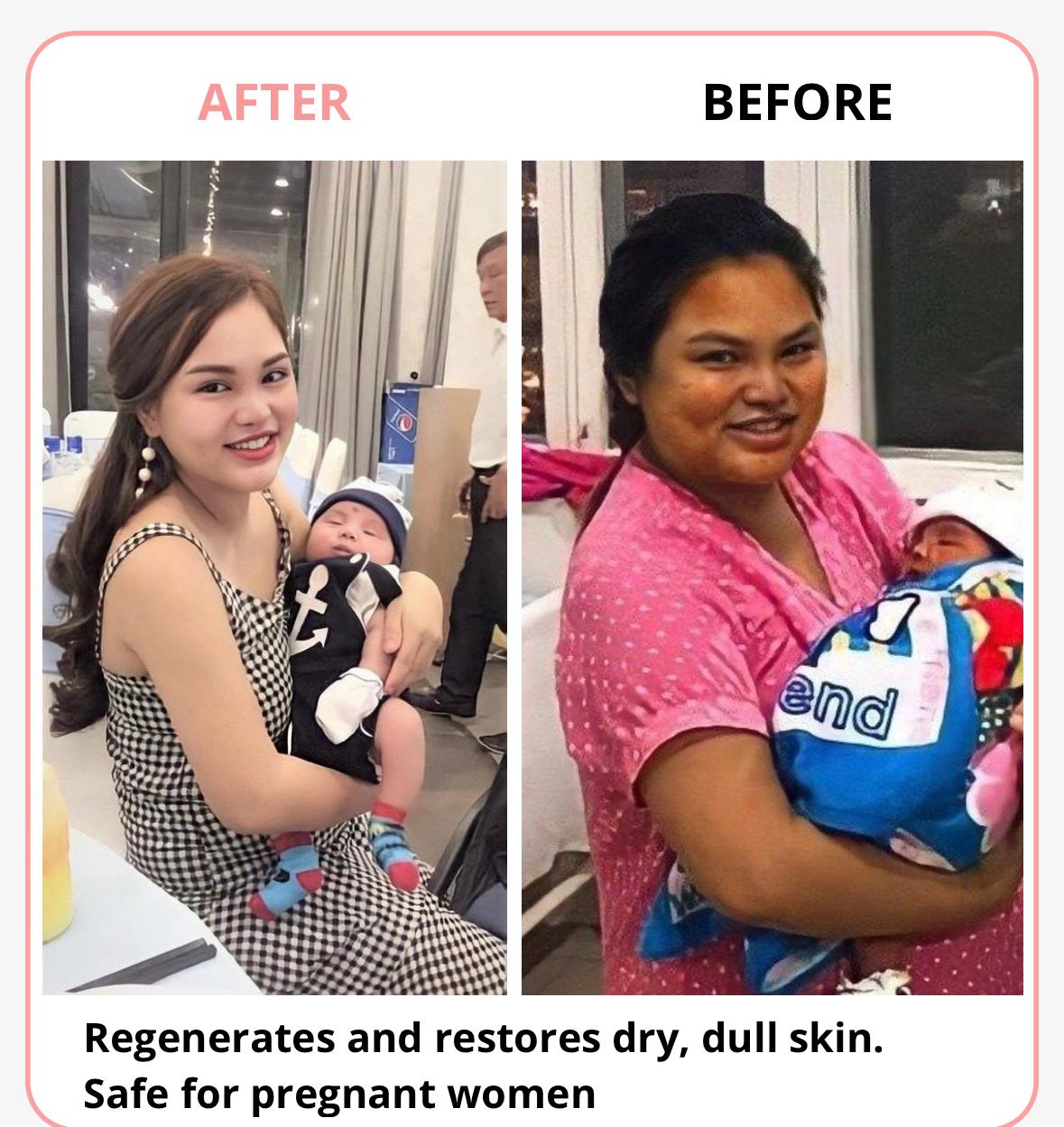 SKIN WHITENING (50% Off) | Skin Whitening Cream Face Brightening Uneven Skin Tone Cream SKIN WHITENING (50% Off)