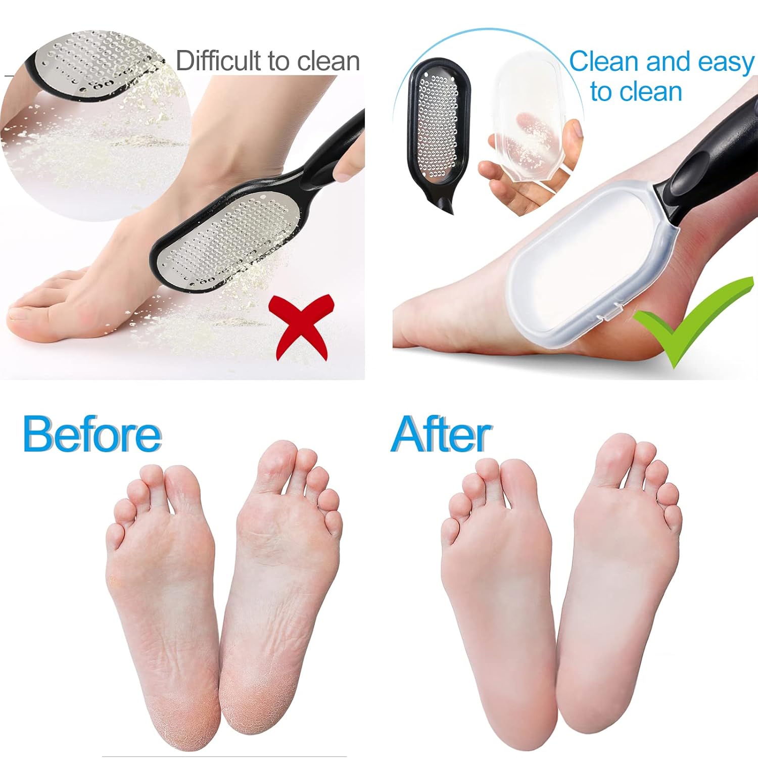 Stainless Steel Foot File | Foot Scrubber Callus Remover Skin Care Products Foot Scrapper - Black - Stainless Steel Foot File