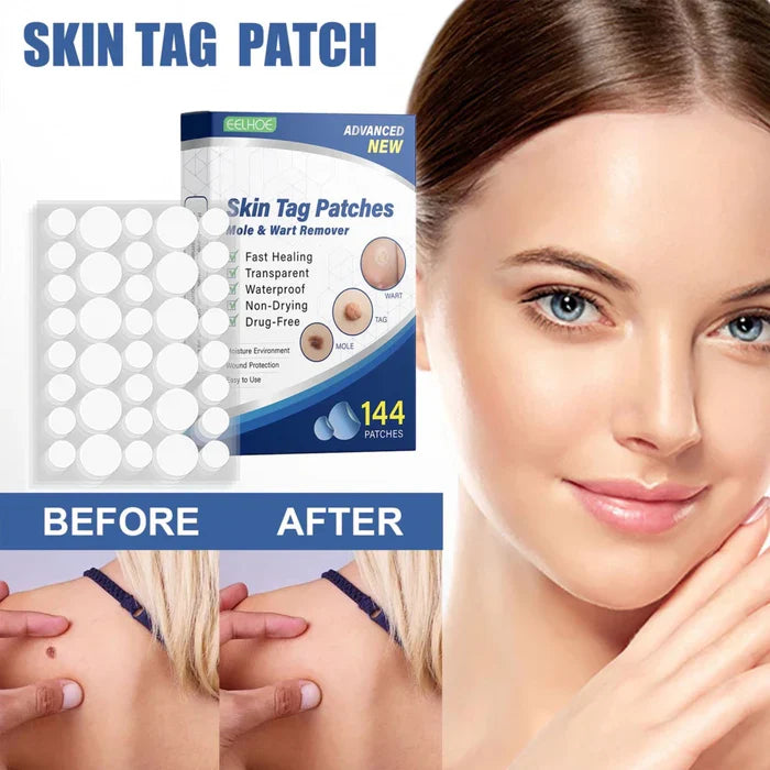 Tag Removal Patch (Pack of 72 pcs) | Skin Tag Removal Wart Care Moles Remove Eliminating Mole - Tag Removal Patch (Pack of 72 pcs)