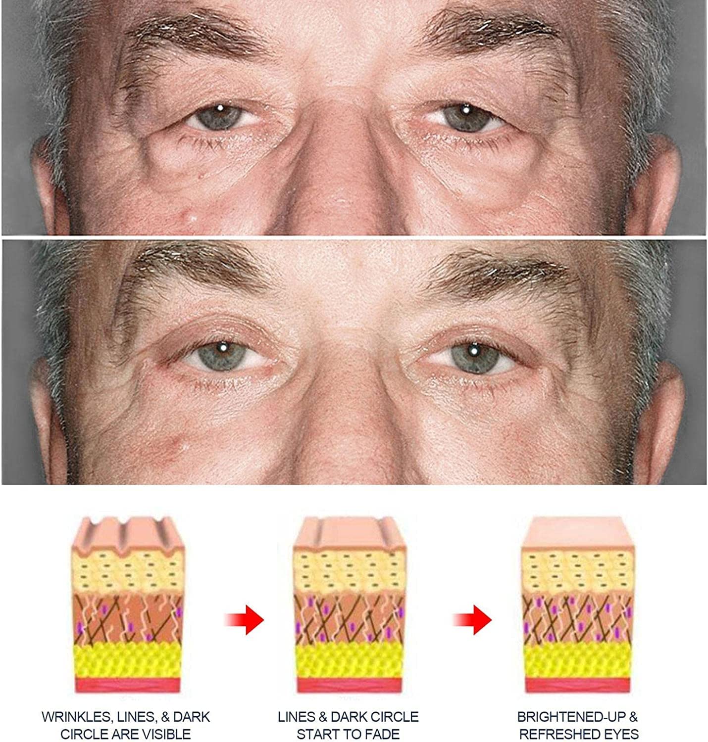 Under Eye Cream For Dark Circles Eyes Lifting Under Eye Gel (50% OFF) Under Eye Gel (50% OFF)