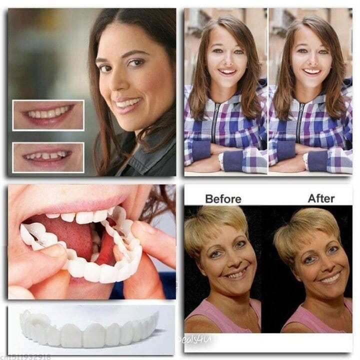 Snap-on Dentures | White Teeth Braces Clip On Veneer Teeth Perfect Dental Braces tool Snap-on Dentures