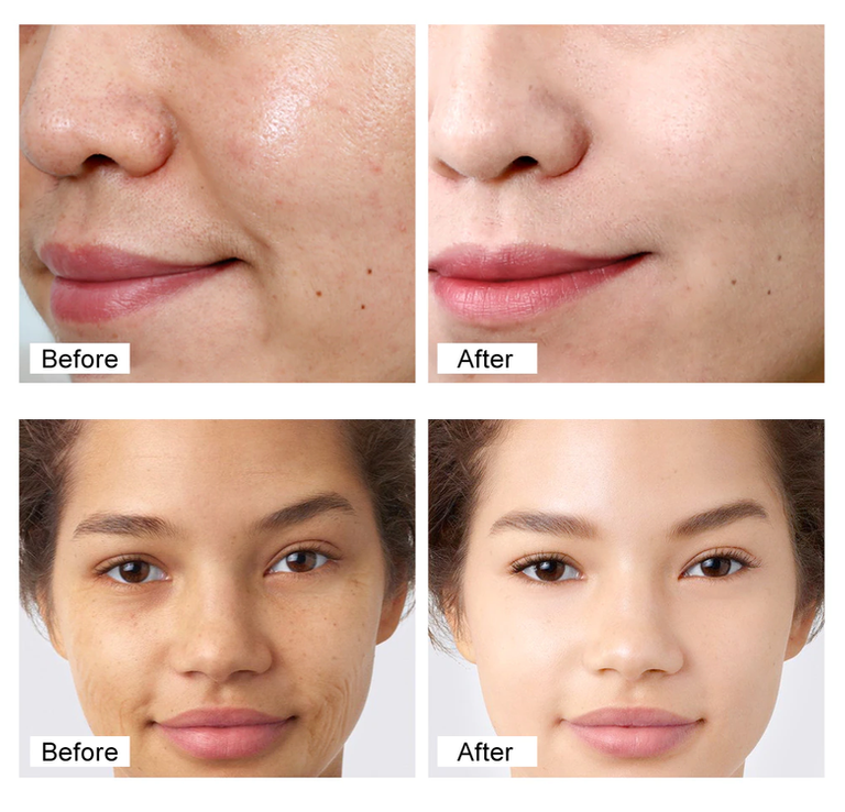 Turmeric Serum