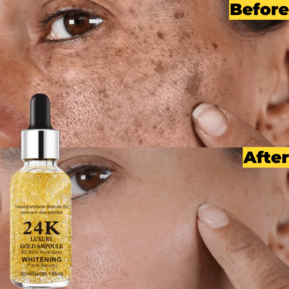 Anti Ageing Serum Dark Circles Anti Wrinkle Oil Under Eye Serum Under Eye Serum 24K Gold Serum (Set of 2)