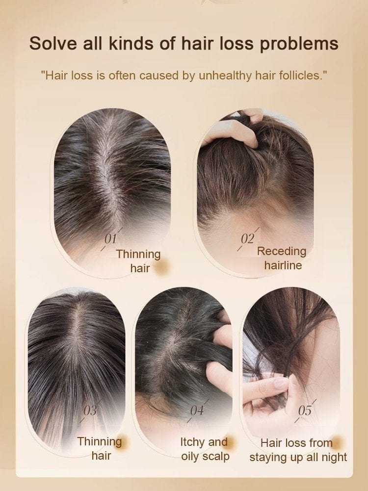 Anti-hairfall Shampoo | Anti Hair Fall Shampoo Hair Growth Ginger Hairex Reduce Hair Loss Ginger Extract Anti-Hairfall Shampoo (Pack of 3)