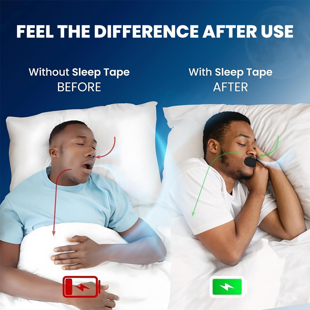 Anti Snoring Mouth Tape (Pack of 30) | Nasal Breathing Strips Breathe Mouth Tape Anti Snoring Tape Mouth - Anti Snoring Mouth Tape (Pack of 30)