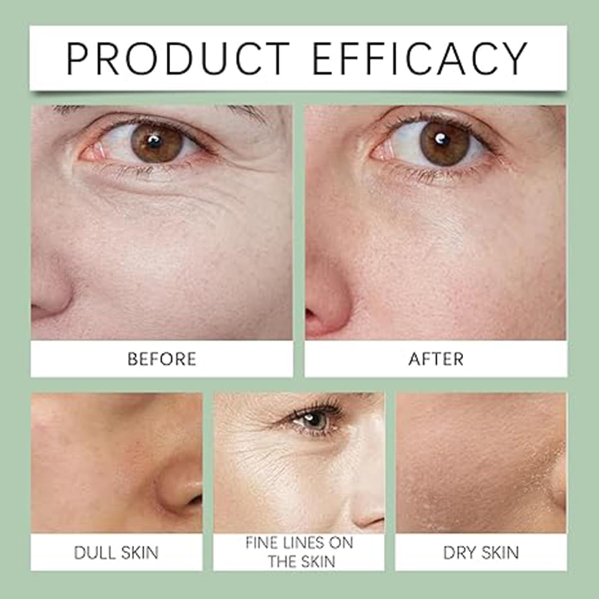 Anti-wrinkle Cream | Anti Wrinkle Serum Cream Products For Women Anti Aging Lotions Anti-Wrinkle Multi-purpose Cream