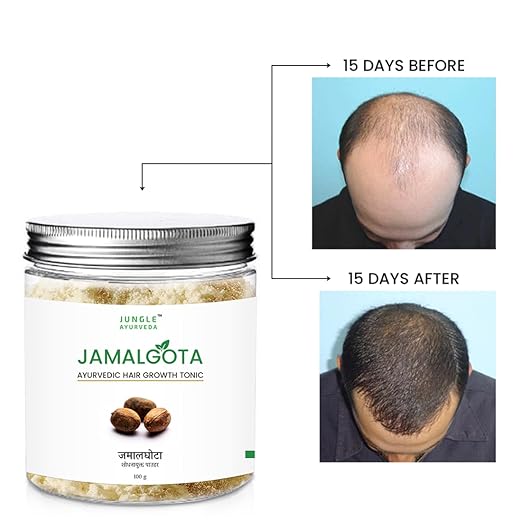 Ayurvedic Hair Growth Powder (Pack of 2) | Hair Care Fall Treatment Ayurvedic Hairline Products - Ayurvedic Hair Growth Powder Jamalgota Ayurvedic Hair Growth Powder (Pack of 2)