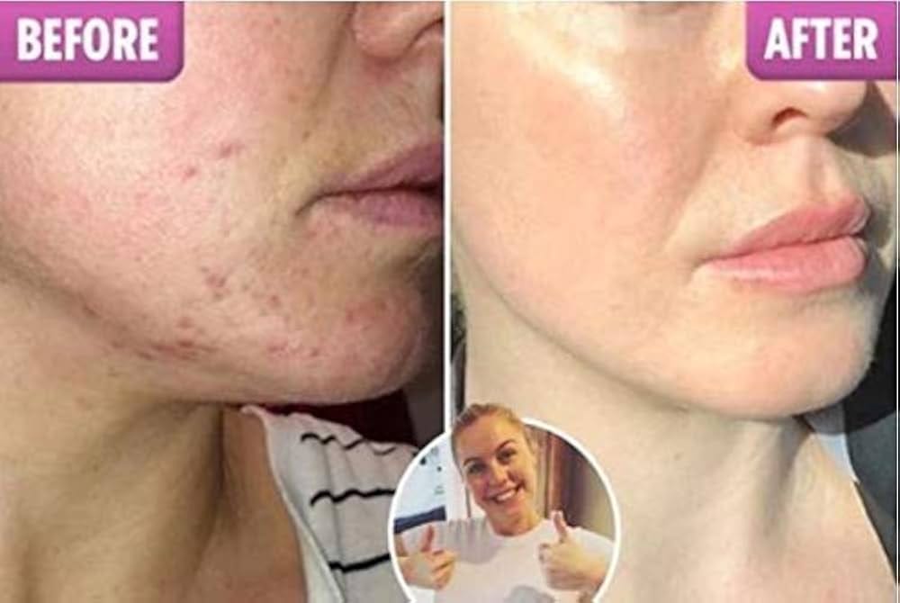 Best CC Cream for Oily and Dry Skin Beauty Face Cream Cc Cream