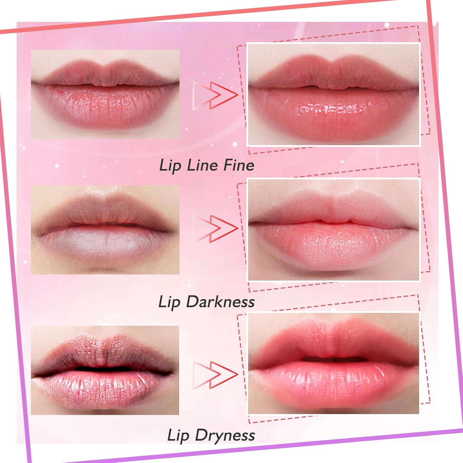 Bio-Collagen Lip Mask (Pack of 5) | Lip Balm Mask Collagen Lips Plump Serum - Bio-Collagen Lip Mask (Pack of 5)