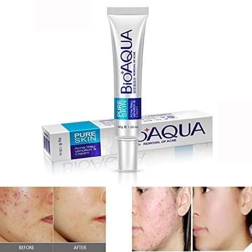 BioAqua Acne & Scar Remover (50% Off) BioAqua Acne & Scar Remover (50% Off)