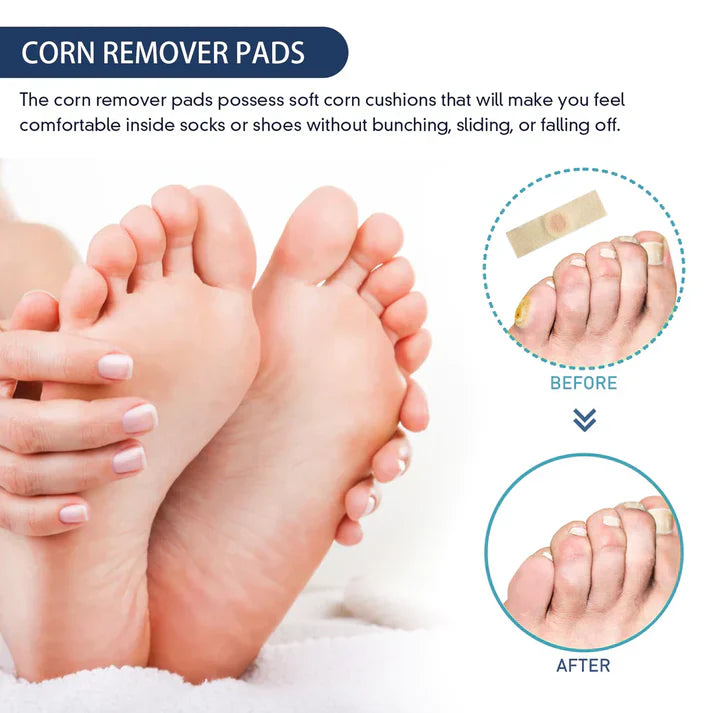 Corn Remover Pads | Corn Remover For Feet Foot Treatment Skin Care Pads - Pack of 12 - Corn Remover Pads