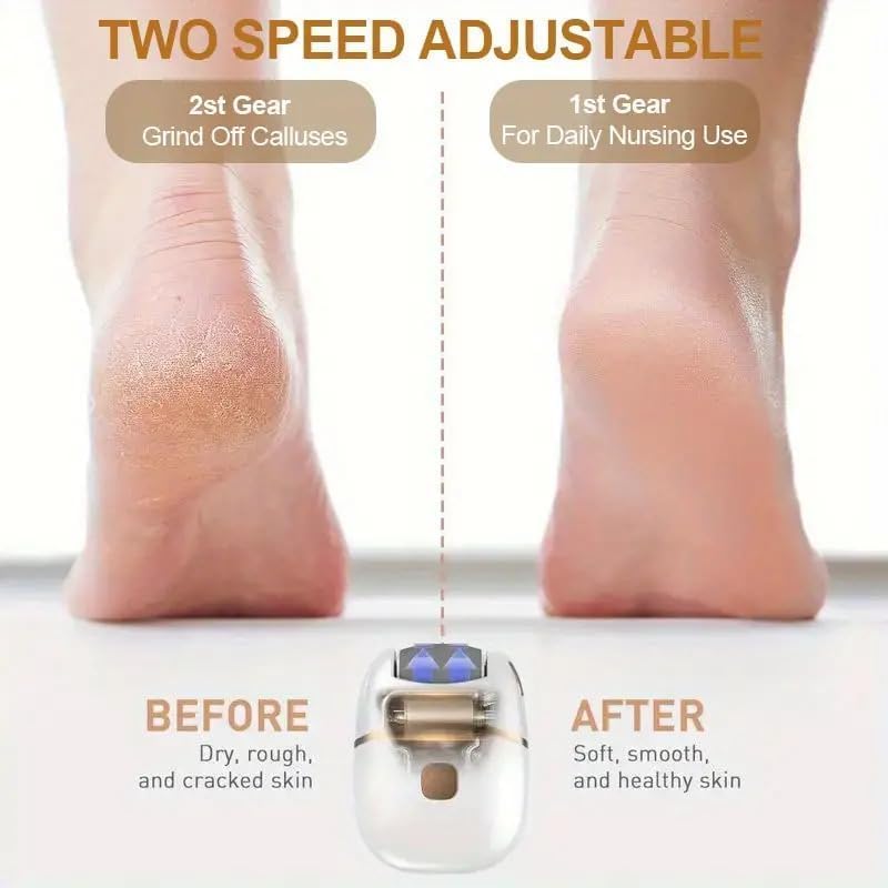 Electric Callus Remover | Callus Remover Manicure Pedicure Foot File Pedicure Tools - Electric Callus Remover
