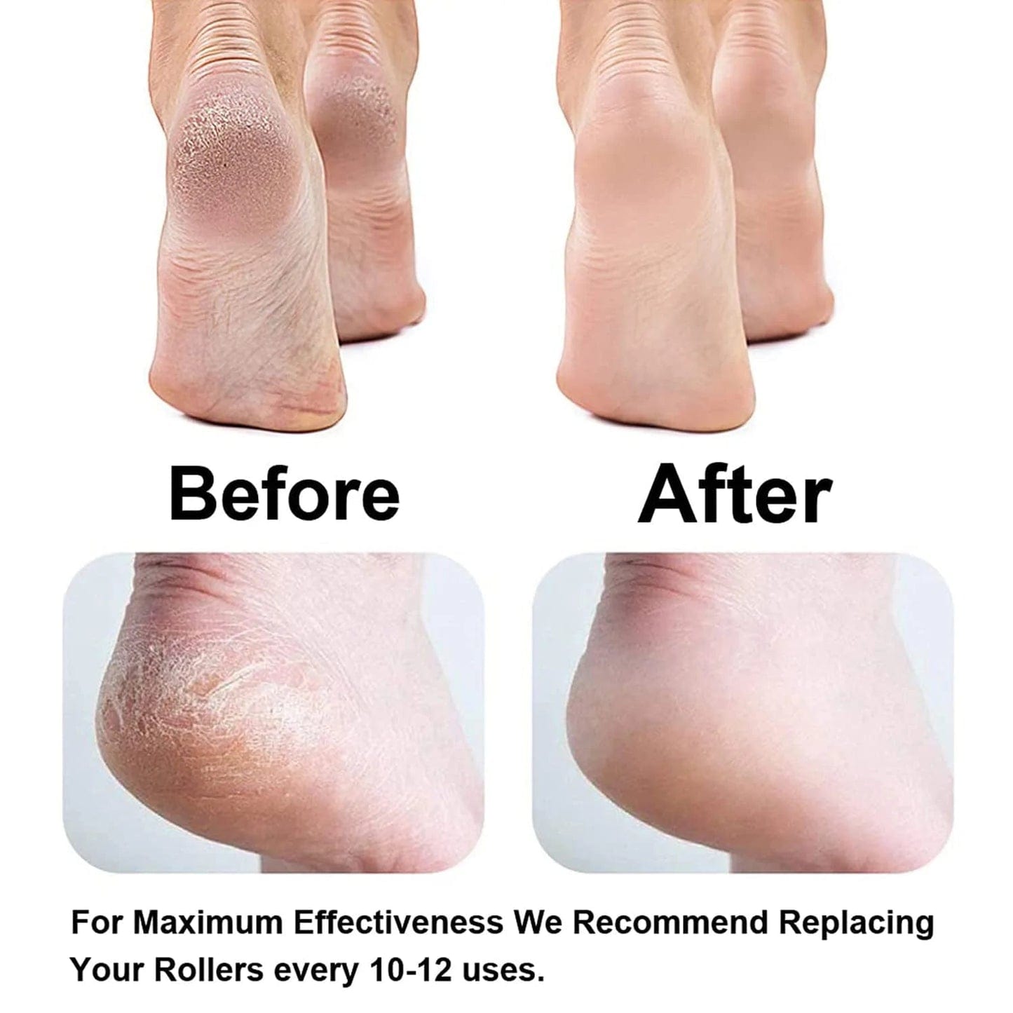 Electric Callus Remover | Foot Treatment Cleaning Electric Callus Pads Electric Callus Remover