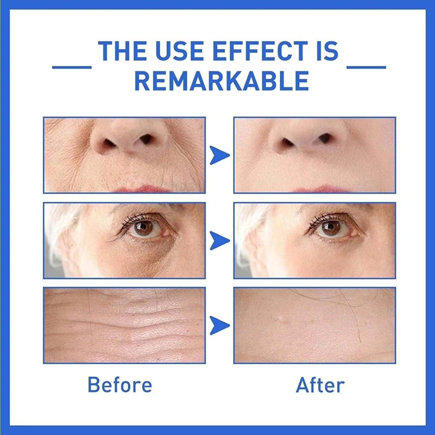 Face Serum Retinol Anti Ageing Serum Retinol For Skin Face Serum (Pack of 2)