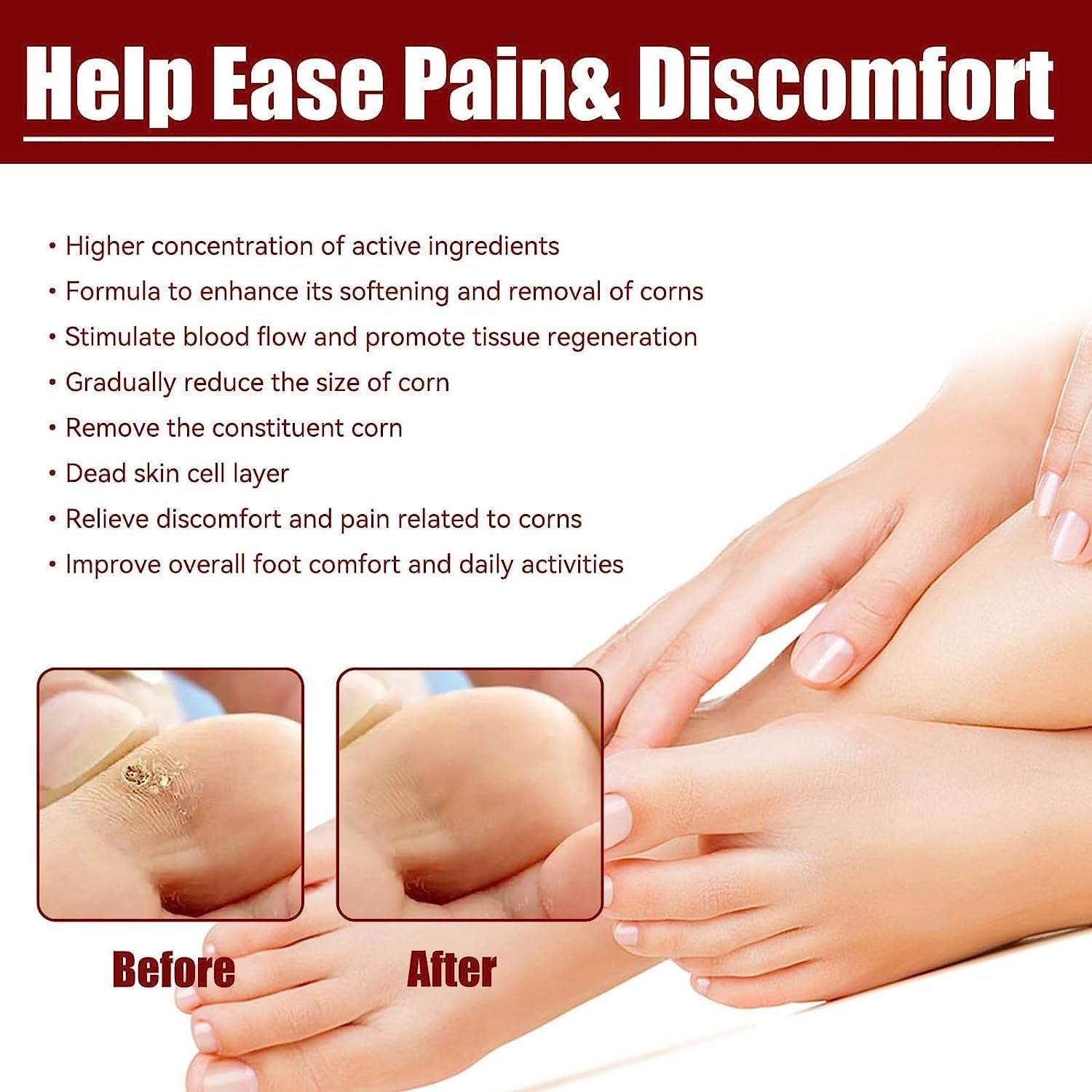 Feet Corn Removal Serum (Pack of 2) | Foot Corn Treatment Corn Healing Feet Corn Removal Serum (Pack of 2)