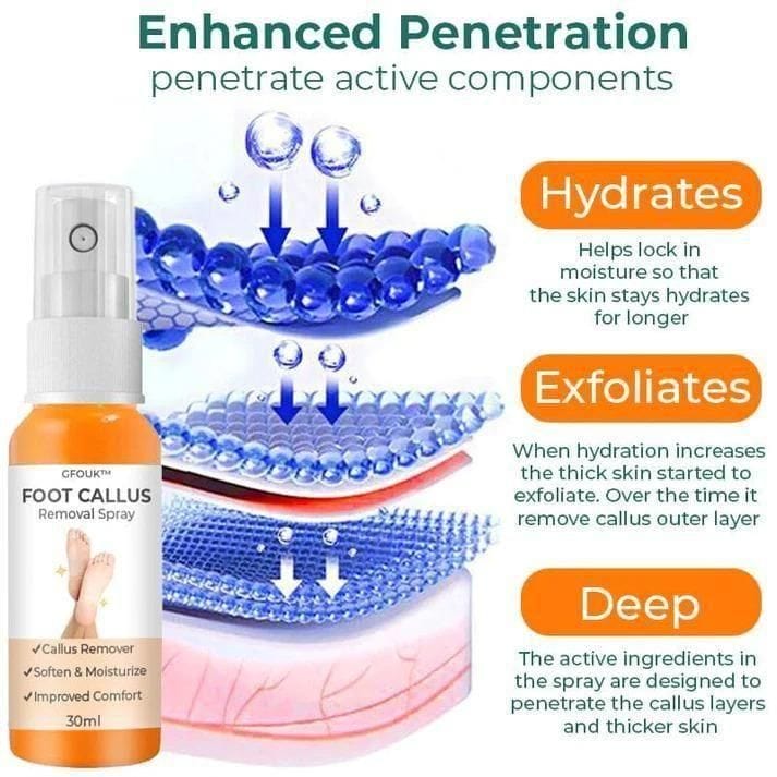 Foot Callus Removal Spray(Pack Of 2) Foot Callus Removal Spray(Pack Of 2)