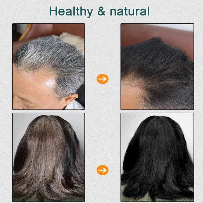 Hair Coloring Dye Shampoo Hair Color Natural Dye Herbal Coloring  - Natural Plant Hair Dye Natural Plant Hair Dye (BUY 1 GET 1 FREE)