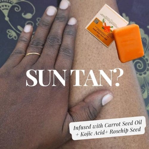 Kojic Body Soap | Skin Whitening Soap Dark Spots On Skin Tone Kojic Body Soap (Pack of 3)