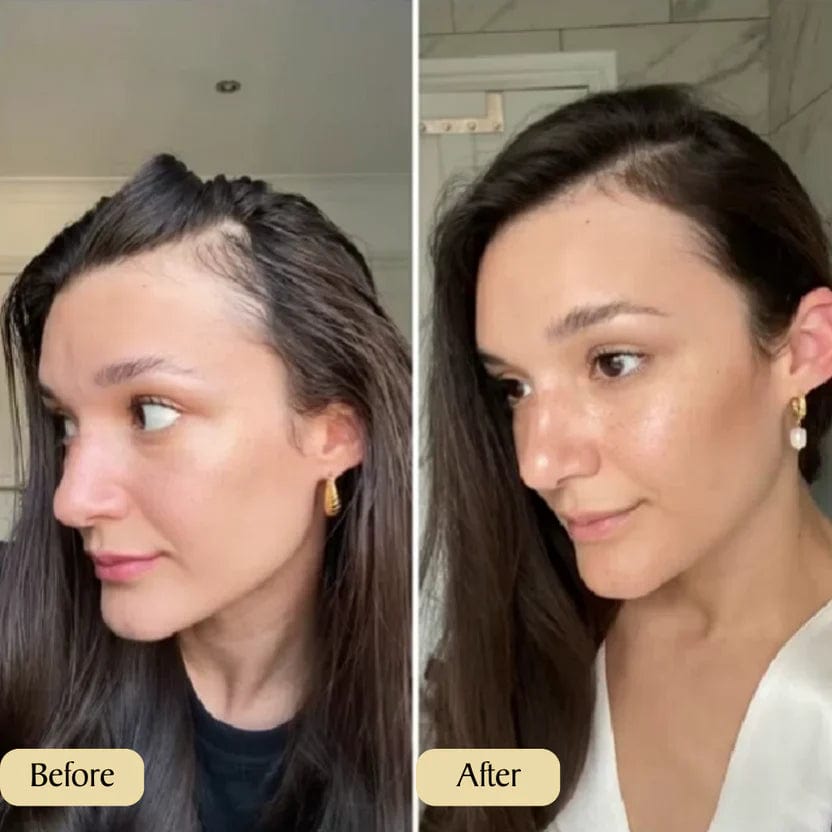 Natural Hair Growth Oil | Fall Control Hairline Growth Oil For Men And Women Natural Hair Growth Oil (BUY 1 GET 1 FREE)