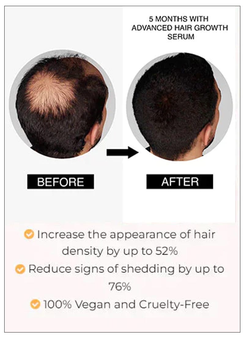 ORGANIC HAIR SERUM ROLLER | Hair Serum For Women Hair Growth Roller Serum  ORGANIC HAIR SERUM ROLLER (BUY 1 GET 1 FREE)