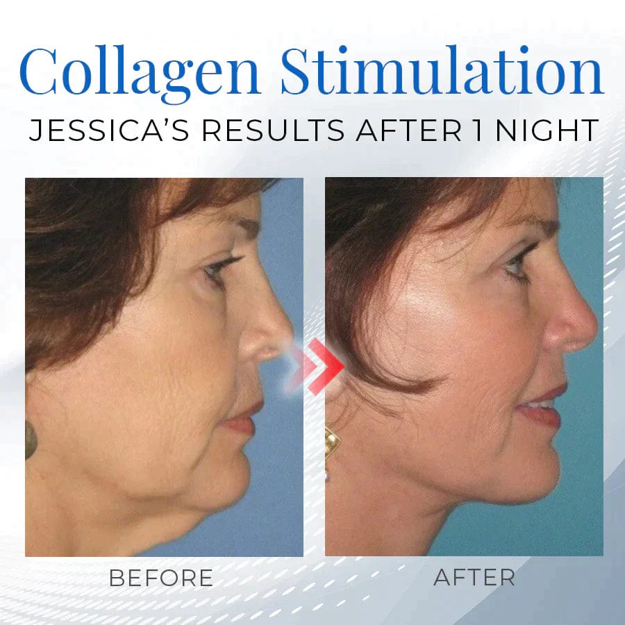 Shaping Face Fat Reducer Double Chin Remover Facial Care Products - Sleeping V-Face Beauty Device Ems Neck Slimming Massager