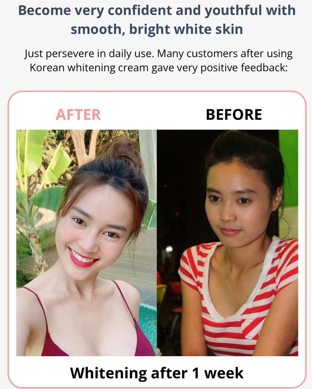 SKIN WHITENING (50% Off) | Skin Whitening Cream Face Brightening Uneven Skin Tone Cream SKIN WHITENING (50% Off)