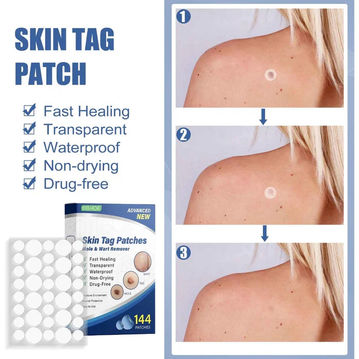 Tag Removal Patch (Pack of 72 pcs) | Skin Tag Removal Wart Care Moles Remove Eliminating Mole - Tag Removal Patch (Pack of 72 pcs)