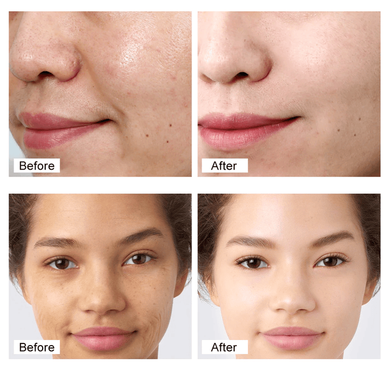 Turmeric Serum | Anti Ageing Serum Dark Spots Skin Tone Antiwrinkle Face ❤️Imported Turmeric Anti Ageing Serum For Both Men & Women🔥 Turmeric Serum