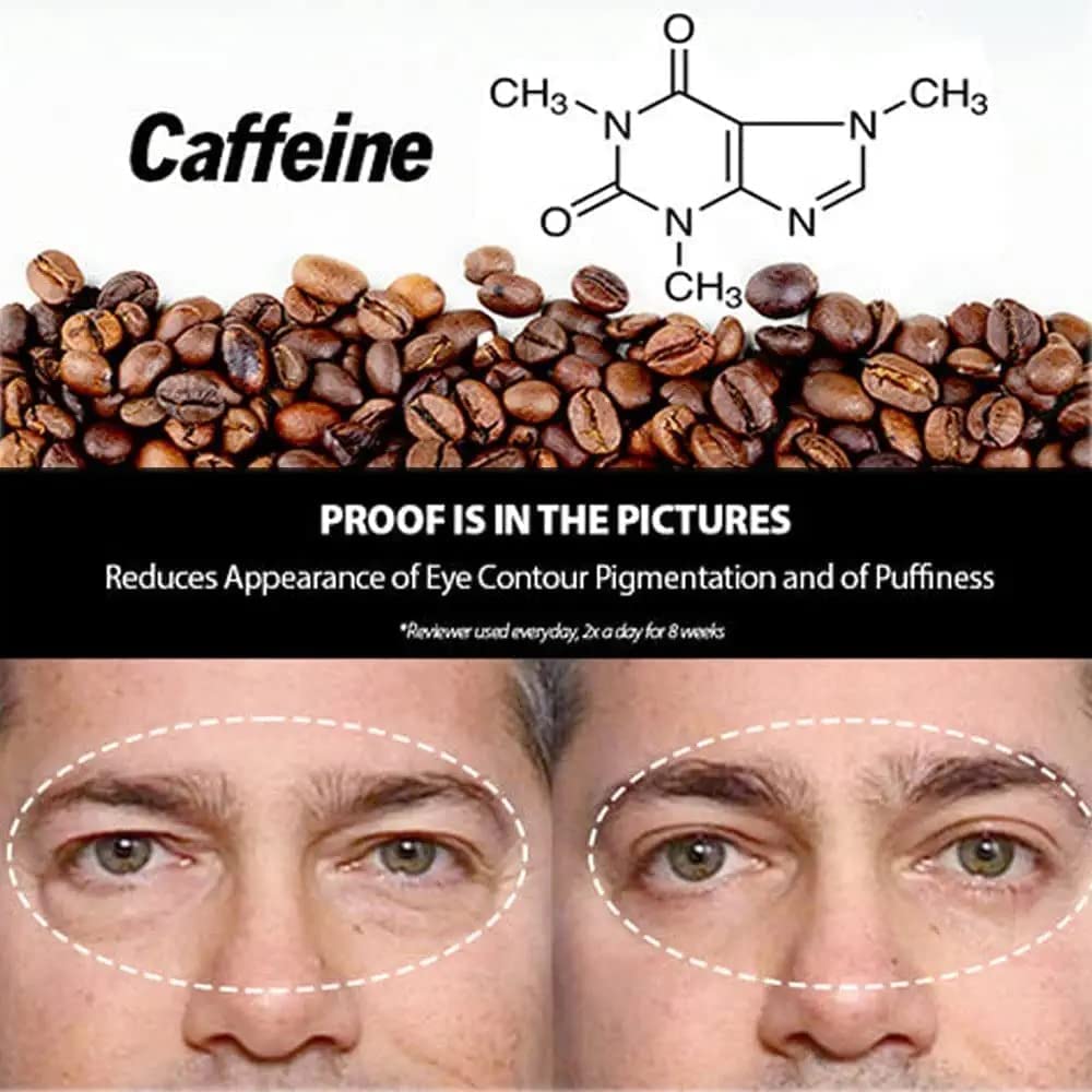 Under Eye Cream For Dark Circles Eyes Lifting Under Eye Gel (50% OFF) Under Eye Gel (50% OFF)