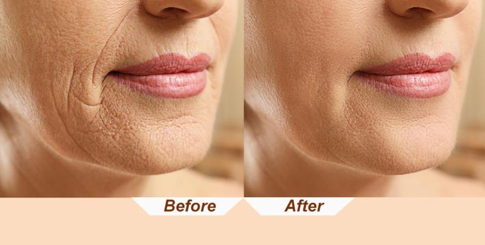 Facial Massager Ultrasonic Face Massage Tool Machine  Ultrasonic Facial Massager