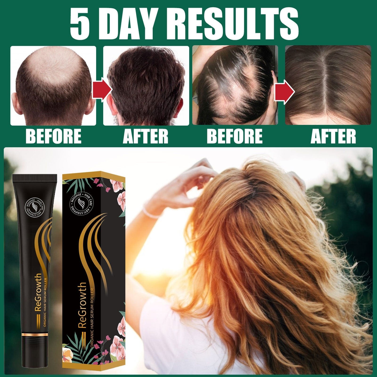 Hair Growth Serum Roller Best Hair Fall Control Scalp Serum Hair Growth Serum Roller
