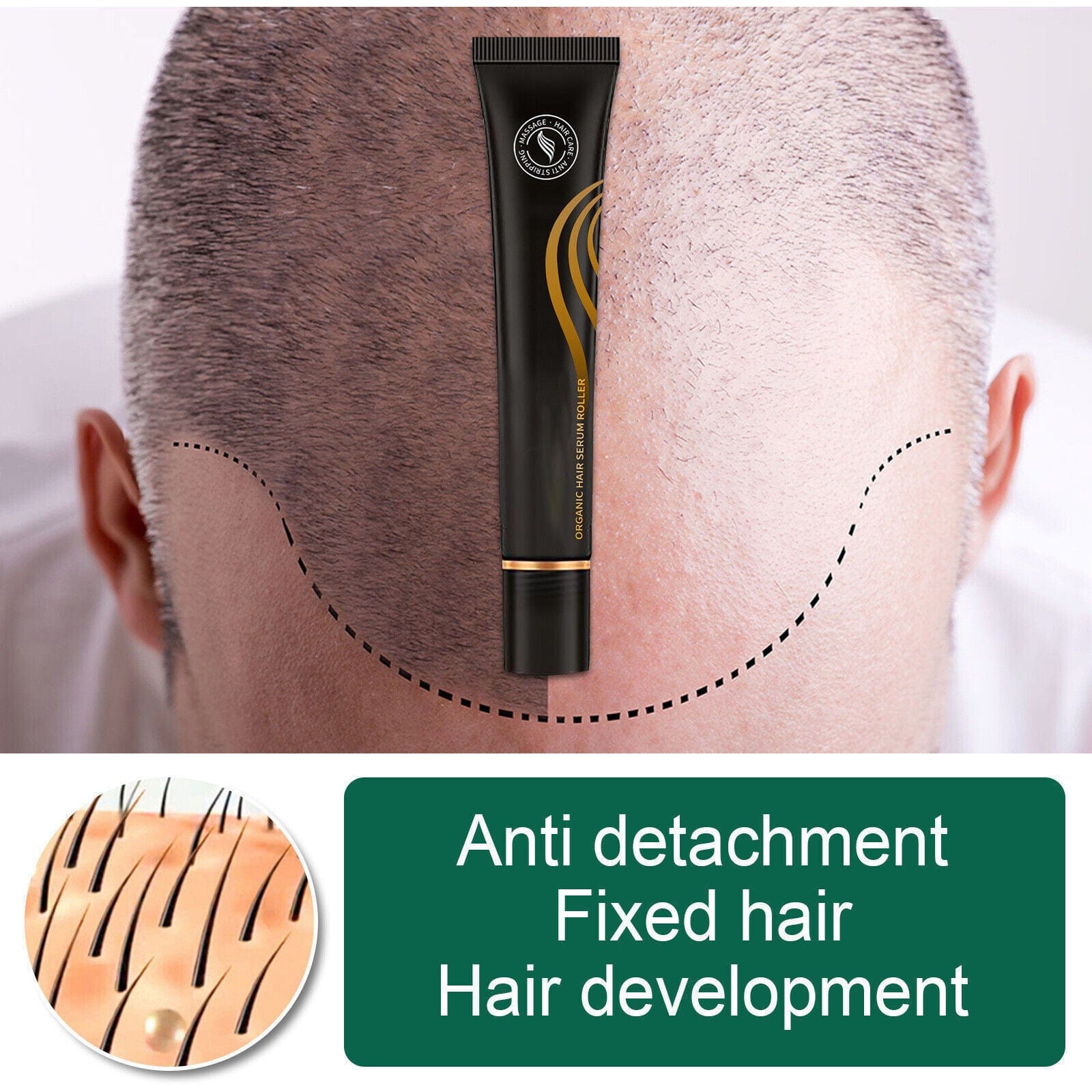 Hair Growth Serum Roller Best Hair Fall Control Scalp Serum Hair Growth Serum Roller