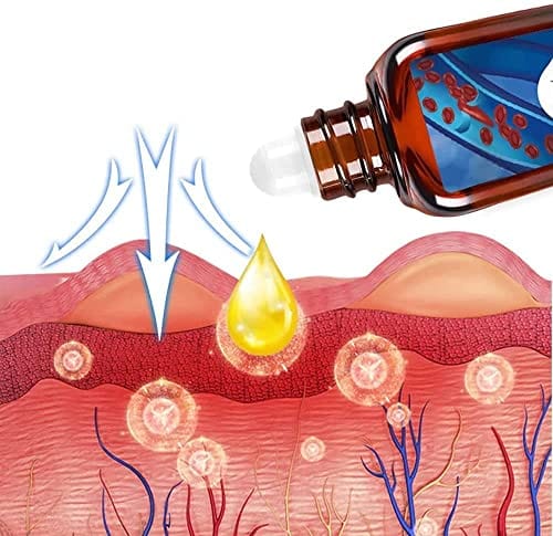 Herbal Varicose Vein Oil - Buy 1 Get 1 Free Herbal Varicose Vein Oil - Buy 1 Get 1 Free