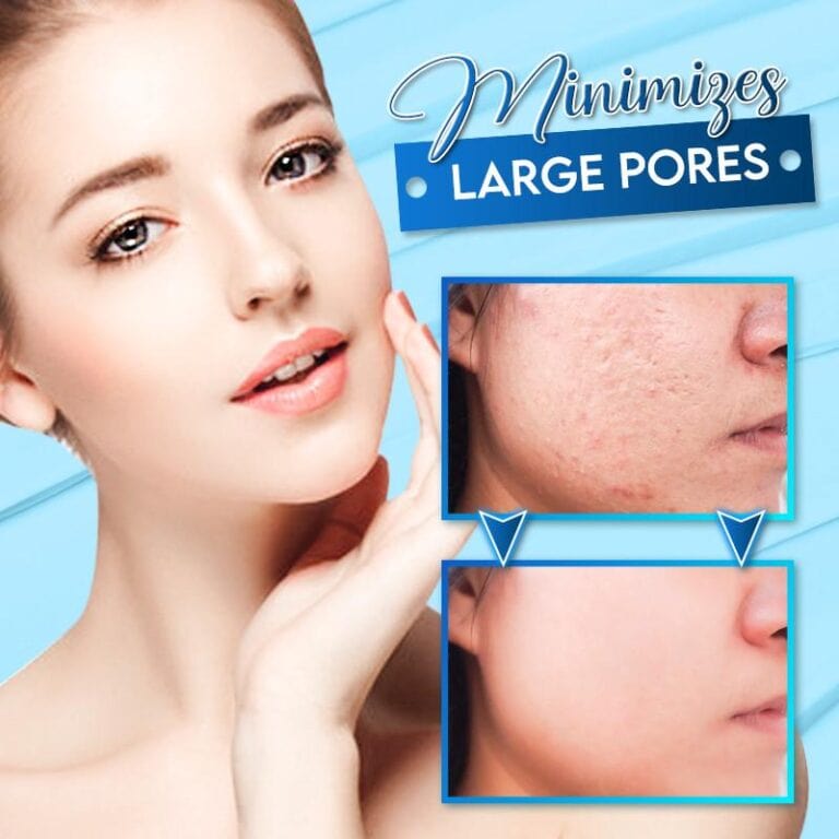 Salicylic Acid Wart Remover Black Head Removal Gel For Acne Salicylic Acid Face Mask